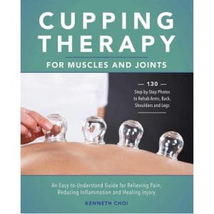 Cupping Therapy for Muscles and Joints